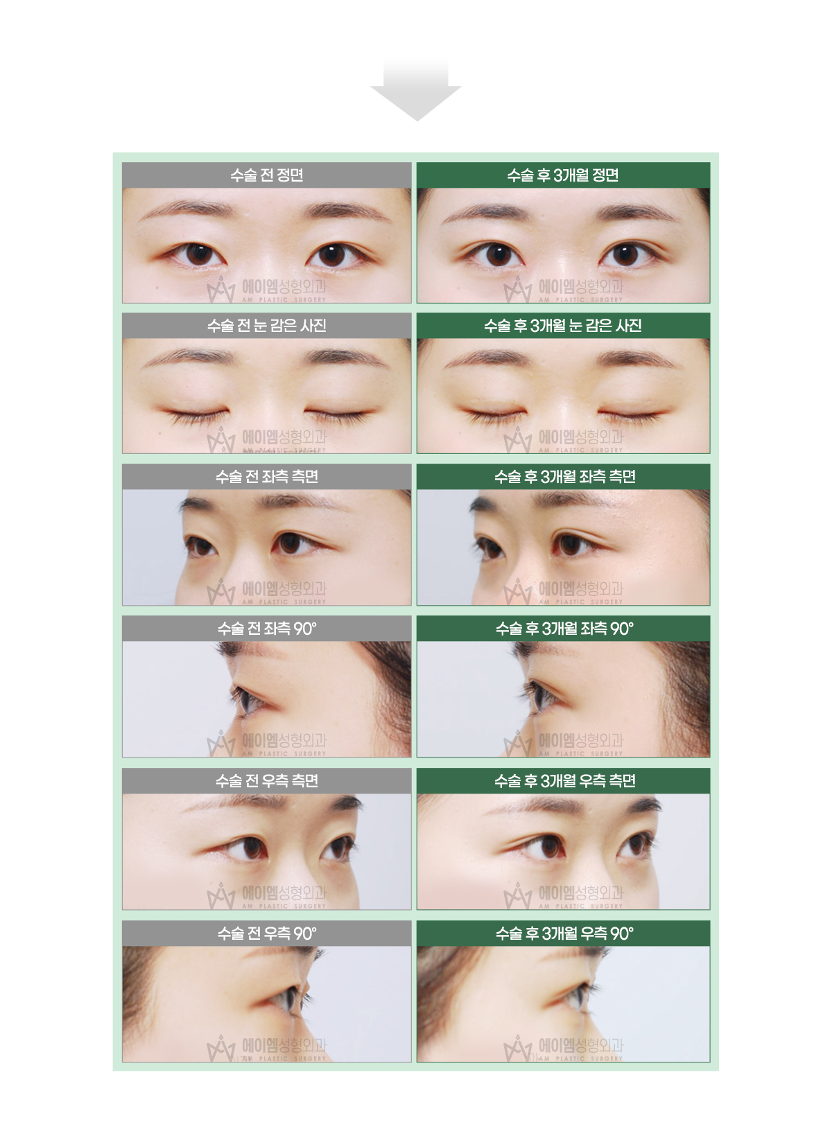 8613e204b5ccf6952ca280b5b336c119_1766026494_1884.jpg 8613e204b5ccf6952ca280b5b336c119_1766026494_1884.jpg